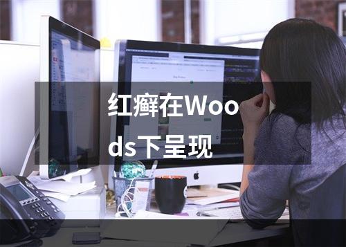 红癣在Woods下呈现