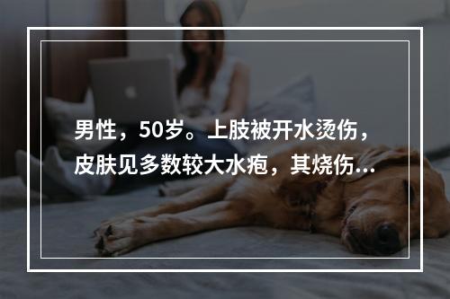 男性，50岁。上肢被开水烫伤，皮肤见多数较大水疱，其烧伤累及