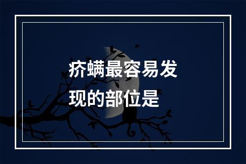 疥螨最容易发现的部位是