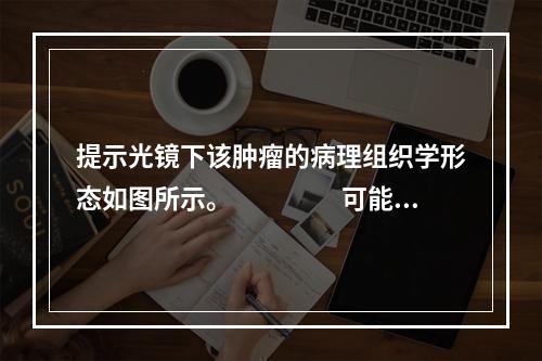 提示光镜下该肿瘤的病理组织学形态如图所示。　　　　可能的病