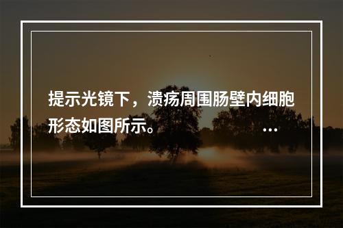 提示光镜下，溃疡周围肠壁内细胞形态如图所示。　　　　　　病理