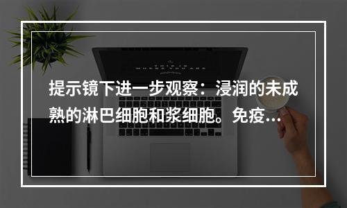 提示镜下进一步观察：浸润的未成熟的淋巴细胞和浆细胞。免疫组织