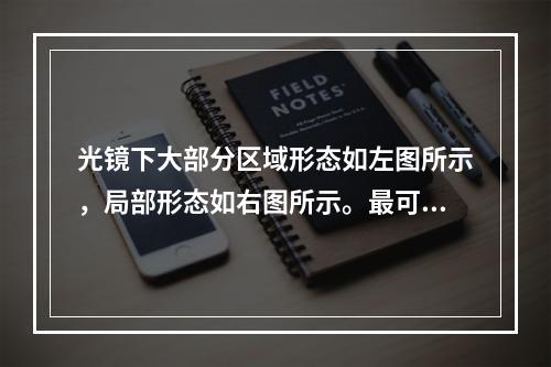 光镜下大部分区域形态如左图所示，局部形态如右图所示。最可能的