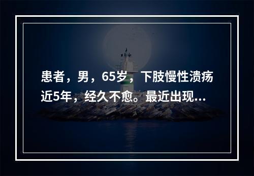 患者，男，65岁，下肢慢性溃疡近5年，经久不愈。最近出现明显