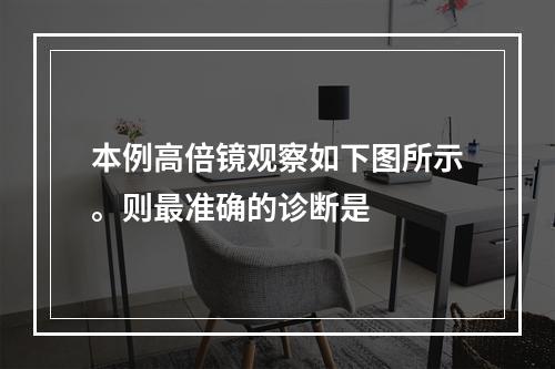 本例高倍镜观察如下图所示。则最准确的诊断是　　