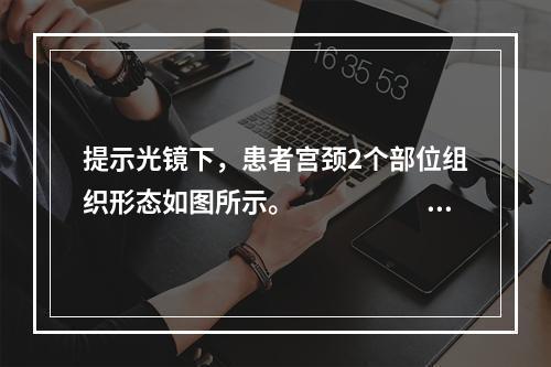 提示光镜下，患者宫颈2个部位组织形态如图所示。　　　　　　病