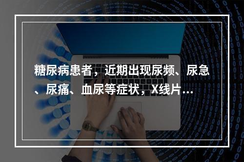 糖尿病患者，近期出现尿频、尿急、尿痛、血尿等症状，X线片可见