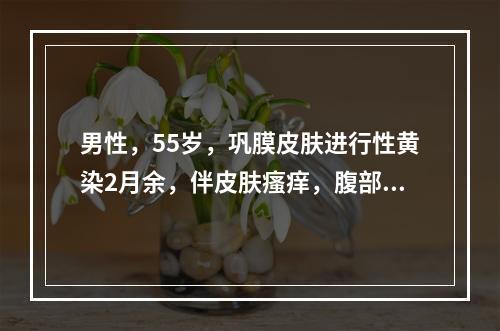 男性，55岁，巩膜皮肤进行性黄染2月余，伴皮肤瘙痒，腹部检查