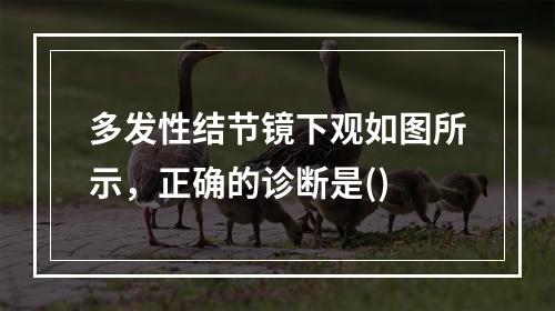 多发性结节镜下观如图所示，正确的诊断是()