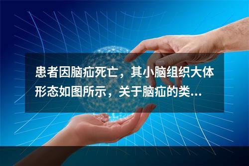 患者因脑疝死亡，其小脑组织大体形态如图所示，关于脑疝的类型下