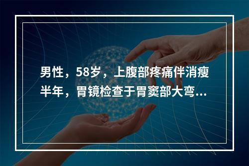 男性，58岁，上腹部疼痛伴消瘦半年，胃镜检查于胃窦部大弯侧见