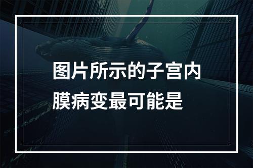 图片所示的子宫内膜病变最可能是