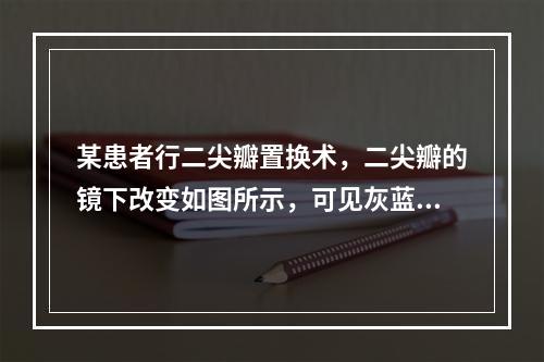 某患者行二尖瓣置换术，二尖瓣的镜下改变如图所示，可见灰蓝色黏