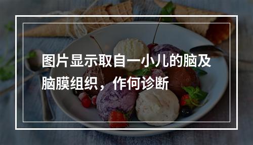 图片显示取自一小儿的脑及脑膜组织，作何诊断　　