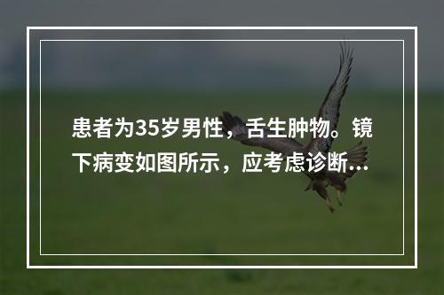 患者为35岁男性，舌生肿物。镜下病变如图所示，应考虑诊断为　