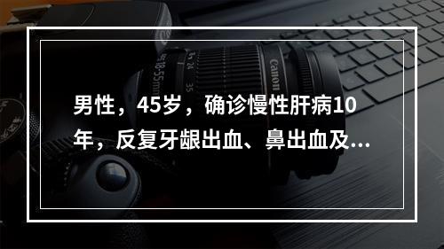 男性，45岁，确诊慢性肝病10年，反复牙龈出血、鼻出血及皮肤