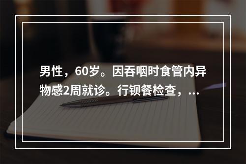 男性，60岁。因吞咽时食管内异物感2周就诊。行钡餐检查，下列