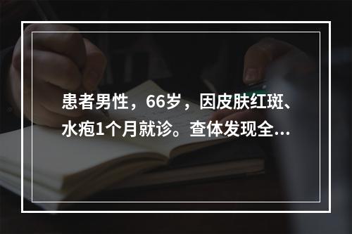 患者男性，66岁，因皮肤红斑、水疱1个月就诊。查体发现全身散