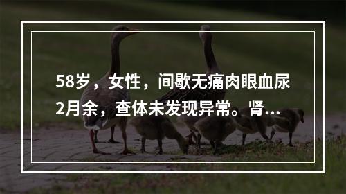 58岁，女性，间歇无痛肉眼血尿2月余，查体未发现异常。肾脏B