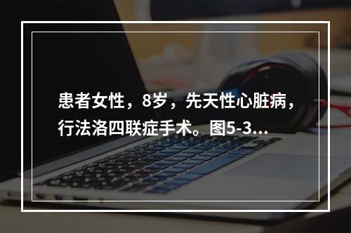 患者女性，8岁，先天性心脏病，行法洛四联症手术。图5-3为术