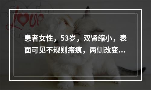 患者女性，53岁，双肾缩小，表面可见不规则瘢痕，两侧改变不对