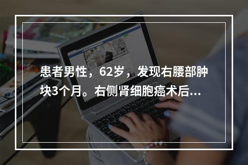 患者男性，62岁，发现右腰部肿块3个月。右侧肾细胞癌术后6年