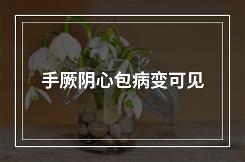 手厥阴心包病变可见