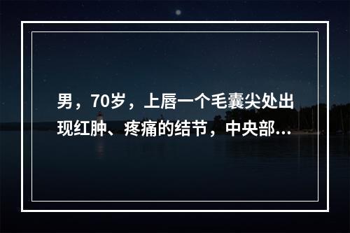 男，70岁，上唇一个毛囊尖处出现红肿、疼痛的结节，中央部有灰