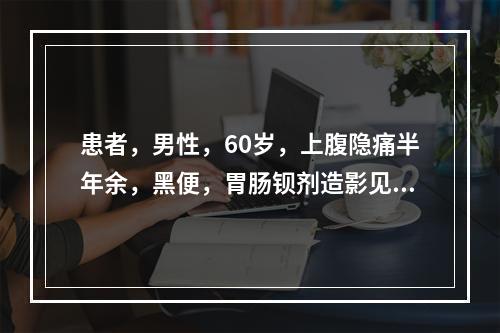 患者，男性，60岁，上腹隐痛半年余，黑便，胃肠钡剂造影见胃小