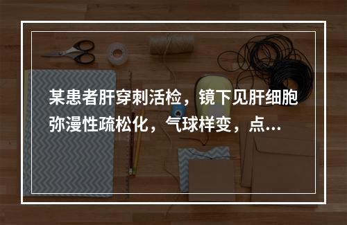 某患者肝穿刺活检，镜下见肝细胞弥漫性疏松化，气球样变，点状坏