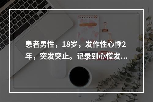 患者男性，18岁，发作性心悸2年，突发突止。记录到心慌发作时