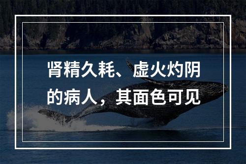 肾精久耗、虚火灼阴的病人，其面色可见