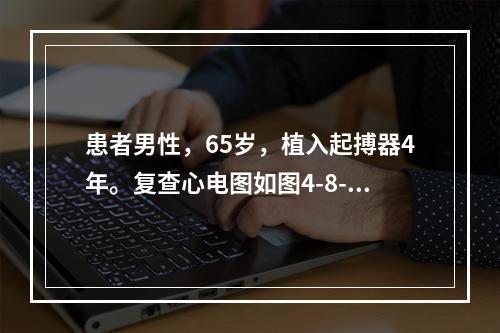 患者男性，65岁，植入起搏器4年。复查心电图如图4-8-8所