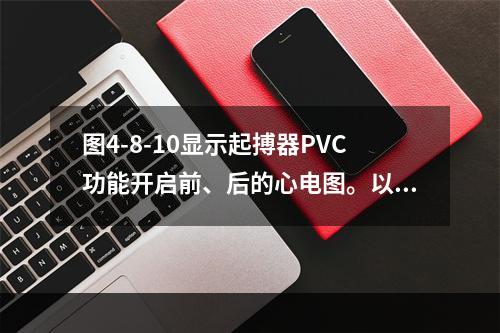 图4-8-10显示起搏器PVC功能开启前、后的心电图。以下为