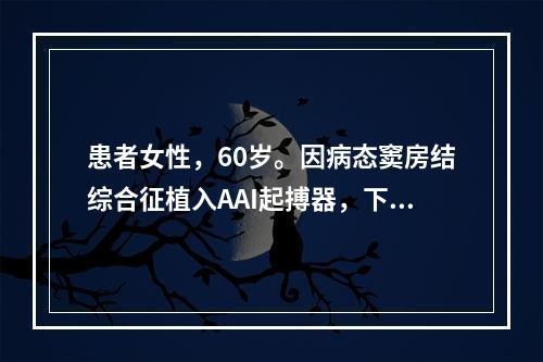 患者女性，60岁。因病态窦房结综合征植入AAI起搏器，下限起