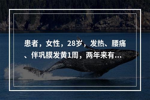 患者，女性，28岁，发热、腰痛、伴巩膜发黄1周，两年来有类似