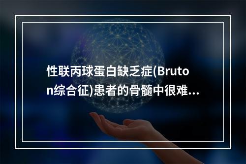 性联丙球蛋白缺乏症(Bruton综合征)患者的骨髓中很难找到