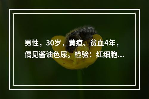 男性，30岁，黄疸、贫血4年，偶见酱油色尿。检验：红细胞2.