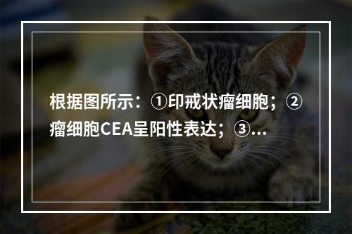 根据图所示：①印戒状瘤细胞；②瘤细胞CEA呈阳性表达；③患者