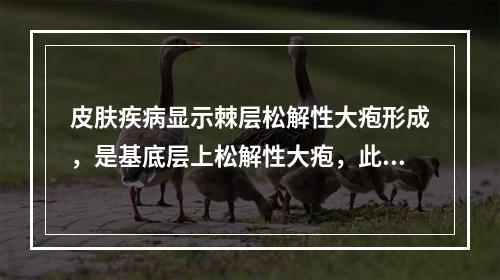 皮肤疾病显示棘层松解性大疱形成，是基底层上松解性大疱，此疱常