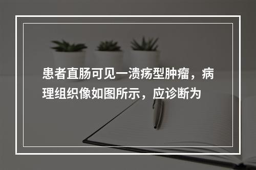 患者直肠可见一溃疡型肿瘤，病理组织像如图所示，应诊断为