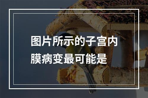 图片所示的子宫内膜病变最可能是