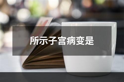 所示子宫病变是