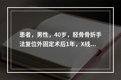 患者，男性，40岁，胫骨骨折手法复位外固定术后1年，X线片提