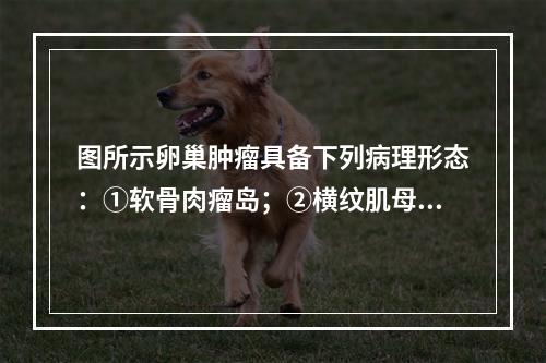 图所示卵巢肿瘤具备下列病理形态：①软骨肉瘤岛；②横纹肌母细胞