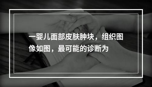 一婴儿面部皮肤肿块，组织图像如图，最可能的诊断为　　