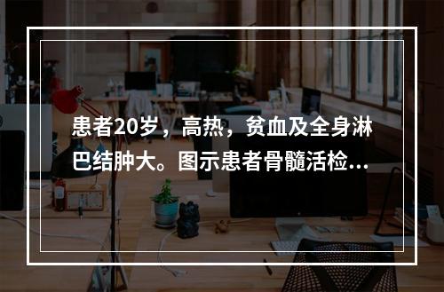 患者20岁，高热，贫血及全身淋巴结肿大。图示患者骨髓活检组织