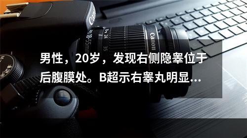 男性，20岁，发现右侧隐睾位于后腹膜处。B超示右睾丸明显萎缩