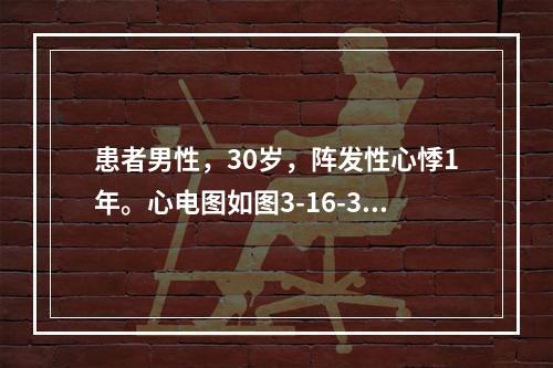 患者男性，30岁，阵发性心悸1年。心电图如图3-16-3所示