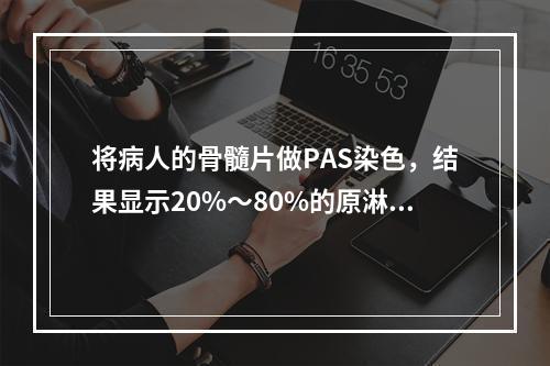 将病人的骨髓片做PAS染色，结果显示20%～80%的原淋巴细